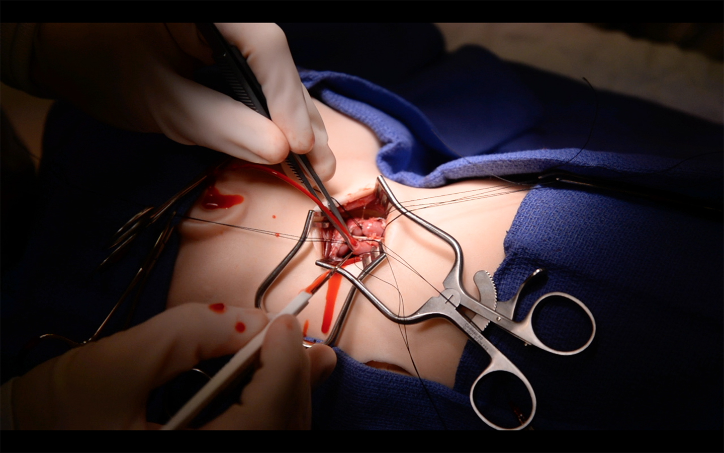 Image of the ECMO Trainer